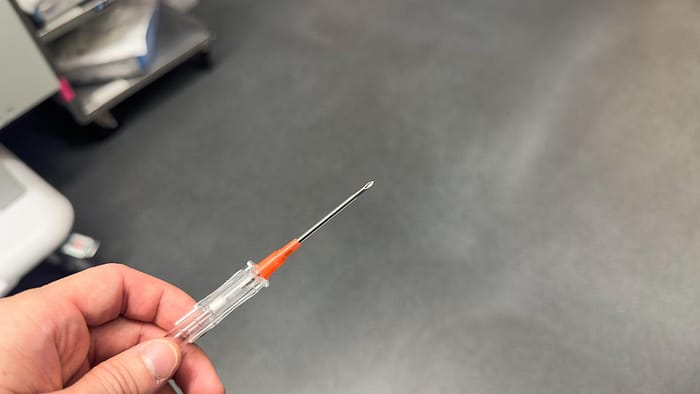 FNAC: Fine Needle Aspiration Cytology Explained for Patients